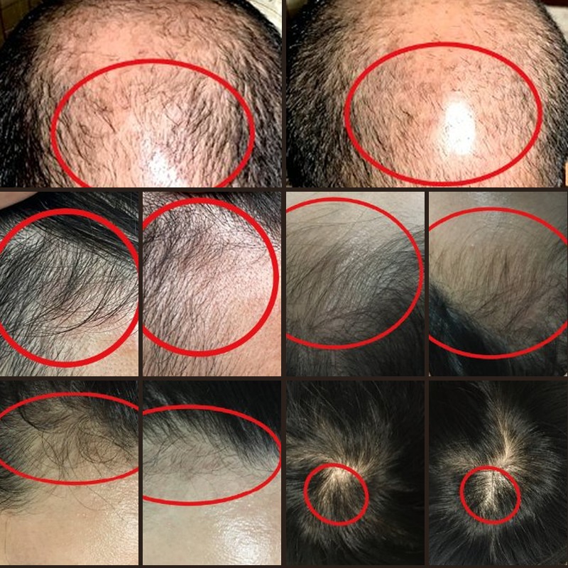 Hair growth and scalp care: before and after clinical results